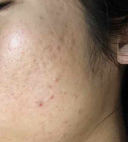 EclatCharme(エクラシャルム)/FABIUS/オールインワン化粧品を使ったクチコミ(3枚目)