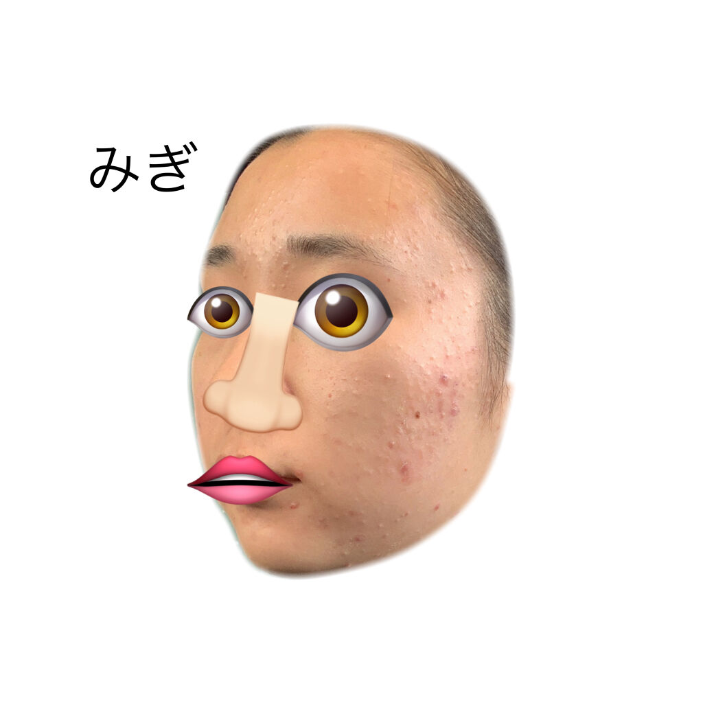 薬用しみ対策 美白化粧水/メラノCC/化粧水を使ったクチコミ（3枚目）