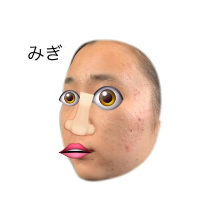 薬用しみ対策 美白化粧水/メラノCC/化粧水を使ったクチコミ(3枚目)