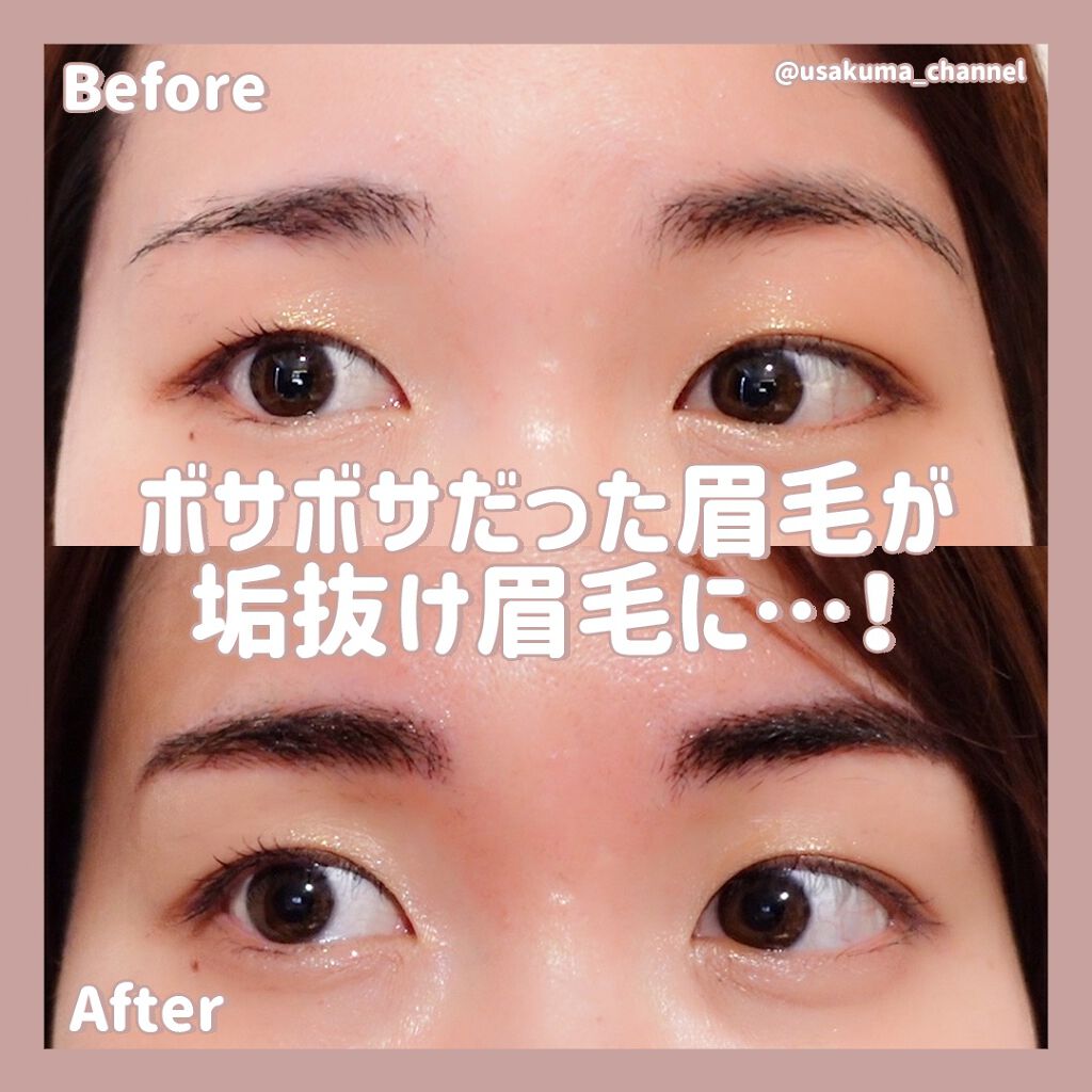 うさくまちゃん@YouTube on LIPS 「人生初の眉毛のアートメイクを渋谷デイジークリニックさんで施術し..」(6枚目)