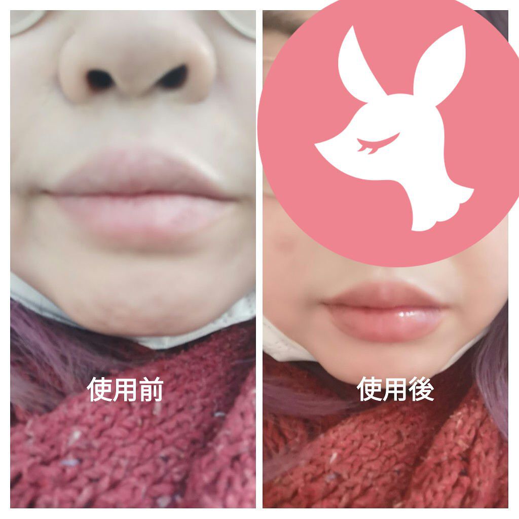 38°C / 99°F リップトリートメント (リップ美容液)/UZU BY FLOWFUSHI/リップケアを使ったクチコミ（2枚目）