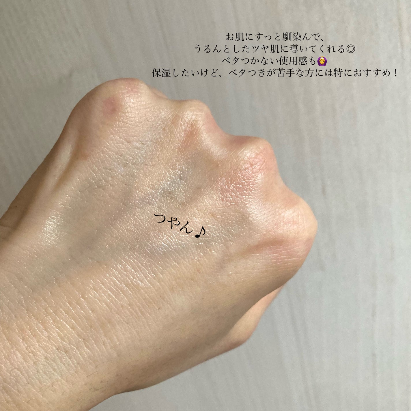 リュール モイストローション III/ジュレリッチ/化粧水を使ったクチコミ(4枚目)