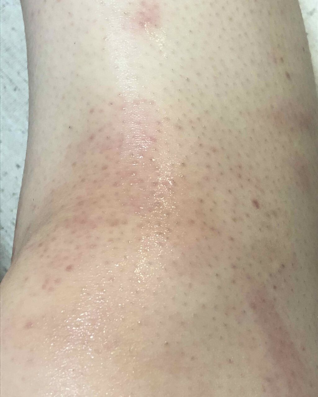 イントゥイション 敏感肌用 ホルダー （刃付き）＋替刃１コ/イントゥイション/シェーバーを使ったクチコミ（3枚目）