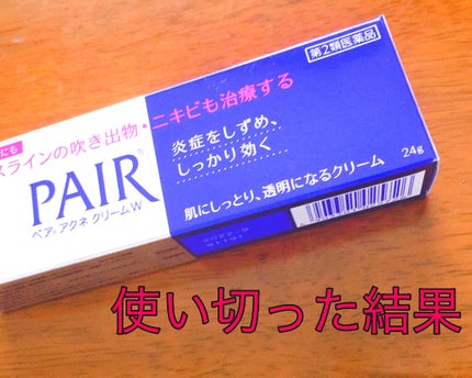 ペアアクネクリームW(医薬品)/ペア/その他を使ったクチコミ(1枚目)