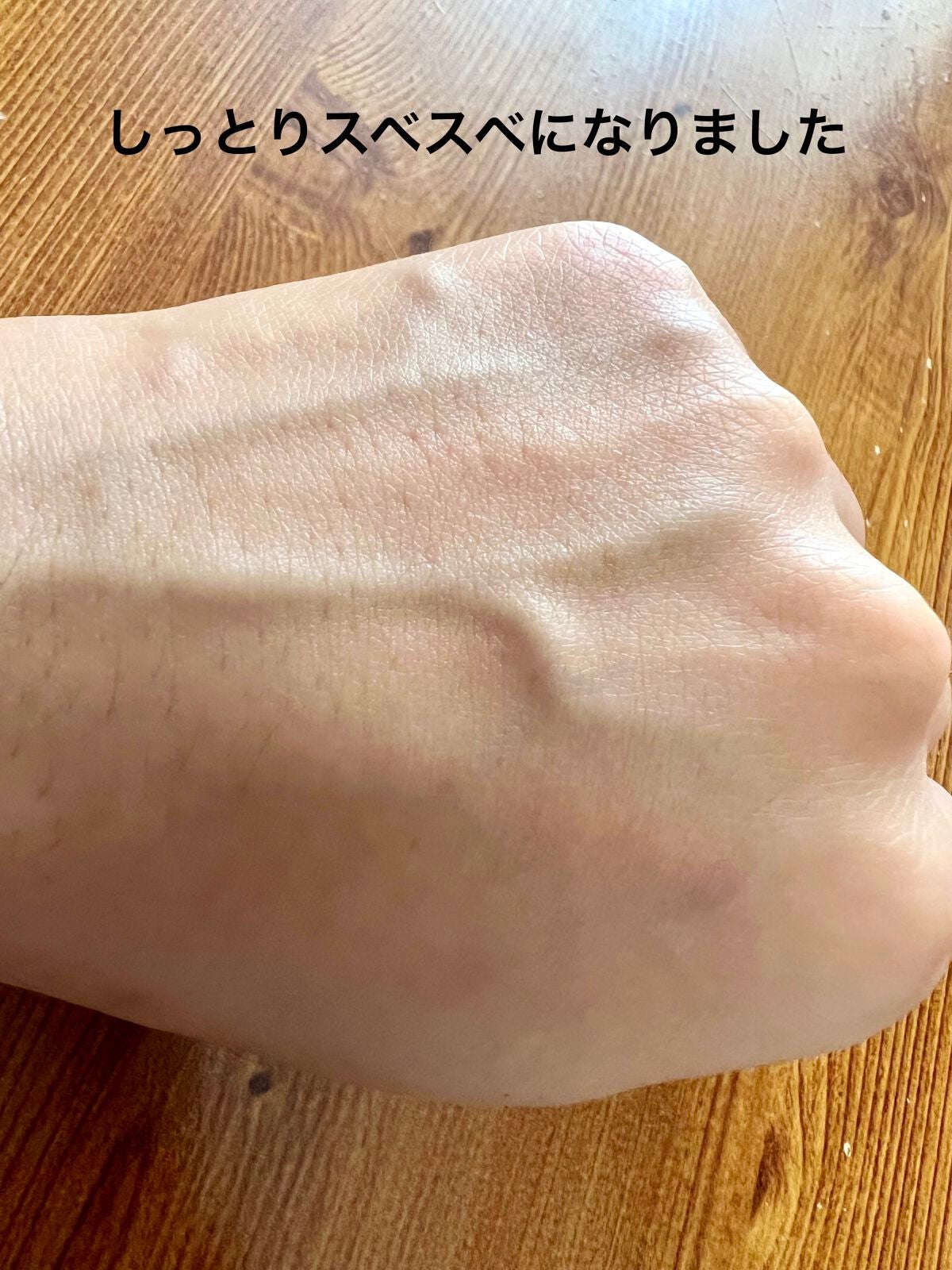 アンブリオデルム モイスチャークリーム/アンブリオリス/フェイスクリームを使ったクチコミ(4枚目)