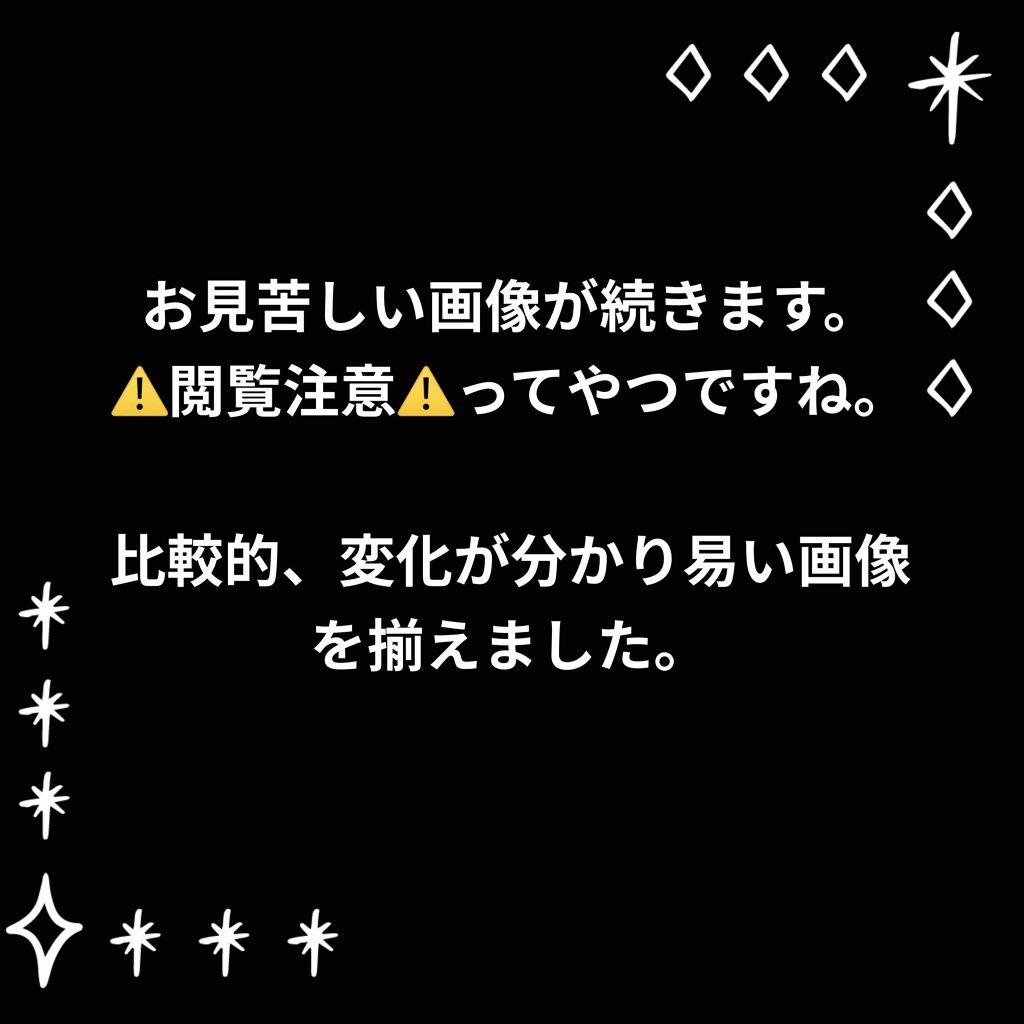 UVローション SPF50+/キュレル/日焼け止め・UVケアを使ったクチコミ（2枚目）
