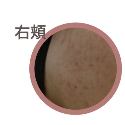 薬用クリーム洗顔/メンソレータム アクネス/洗顔フォームを使ったクチコミ(2枚目)