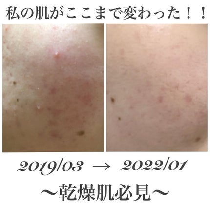 モイストフルCL ファーストエッセンス/ETUDE/ブースター・導入液を使ったクチコミ(1枚目)
