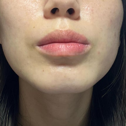 アップトゥーミー ハグマイリップ カラーロックプランパー/up2me/リッププランパーを使ったクチコミ(7枚目)