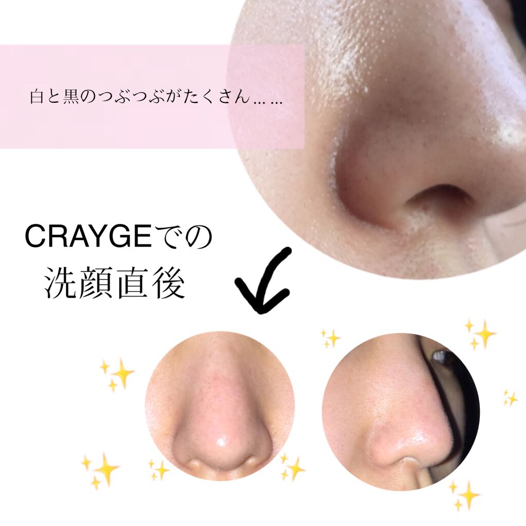 クレンジングバーム モイスト/CLAYGE/クレンジングバームを使ったクチコミ(3枚目)