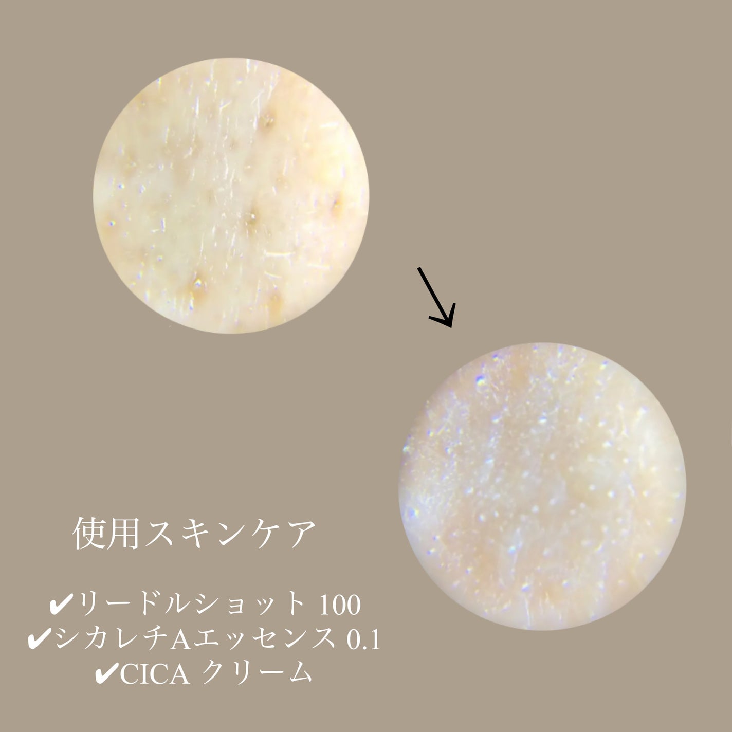 リードルショット100/VT/美容液を使ったクチコミ(4枚目)