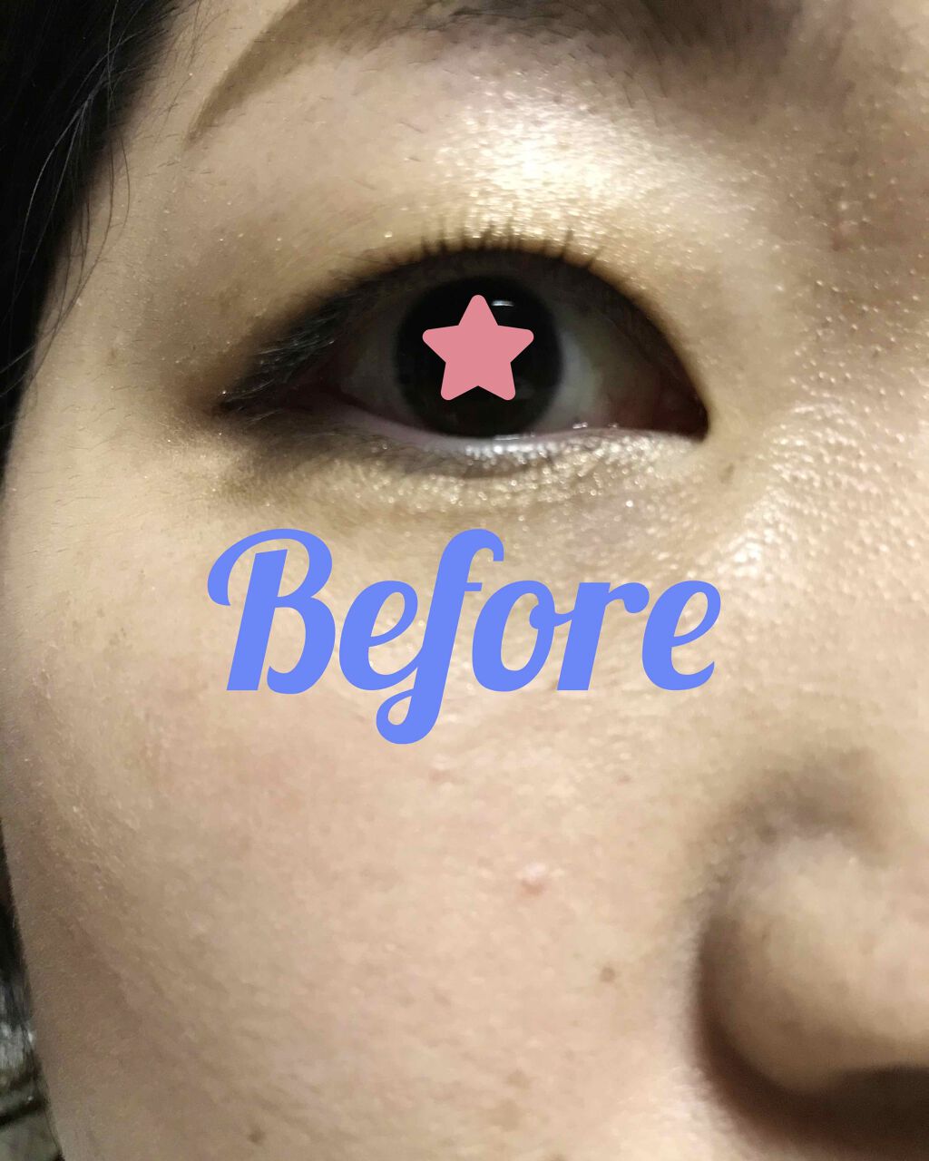 ひとえ・奥ぶたえ用カーラー/アイプチ®/ビューラーを使ったクチコミ（2枚目）