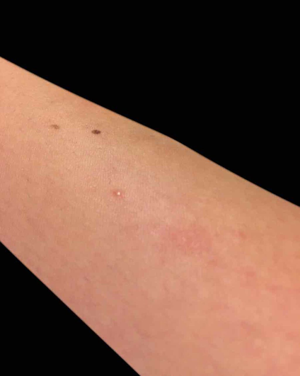 ハトムギ化粧水(ナチュリエ スキンコンディショナー R )/ナチュリエ/化粧水を使ったクチコミ(2枚目)