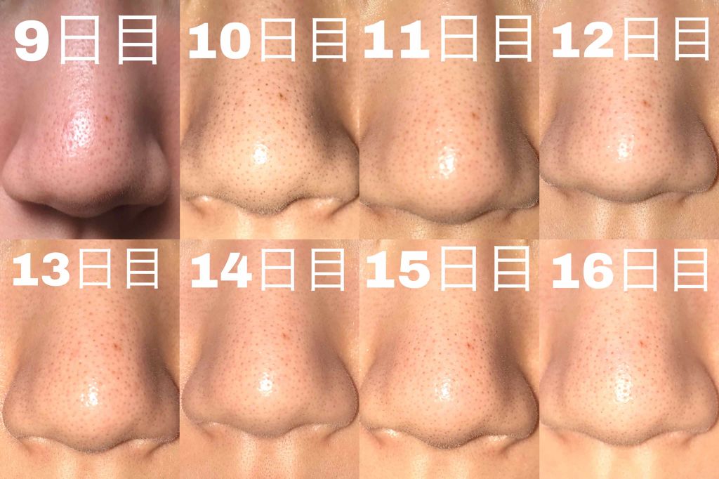 マジックソープ ローズ/ドクターブロナー/ボディソープを使ったクチコミ（2枚目）