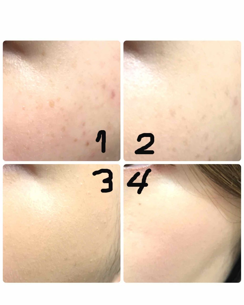 カバーパーフェクション チップコンシーラー/the SAEM/リキッドコンシーラーを使ったクチコミ（3枚目）