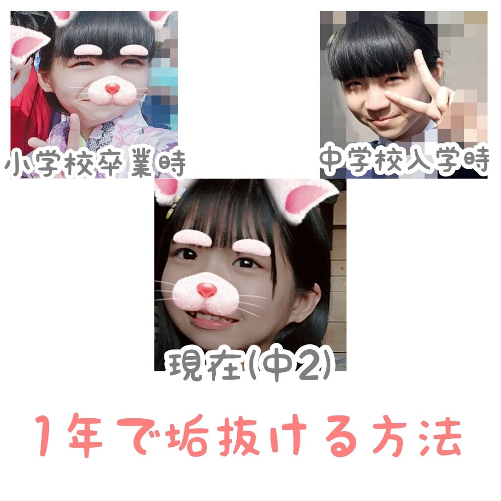 メジカライナー ナイト＆ハード/シェモア/二重まぶた用アイテムを使ったクチコミ（1枚目）