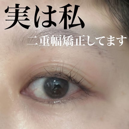 メジカルファイバー2/Automatic Beauty/二重まぶた用アイテムを使ったクチコミ(1枚目)
