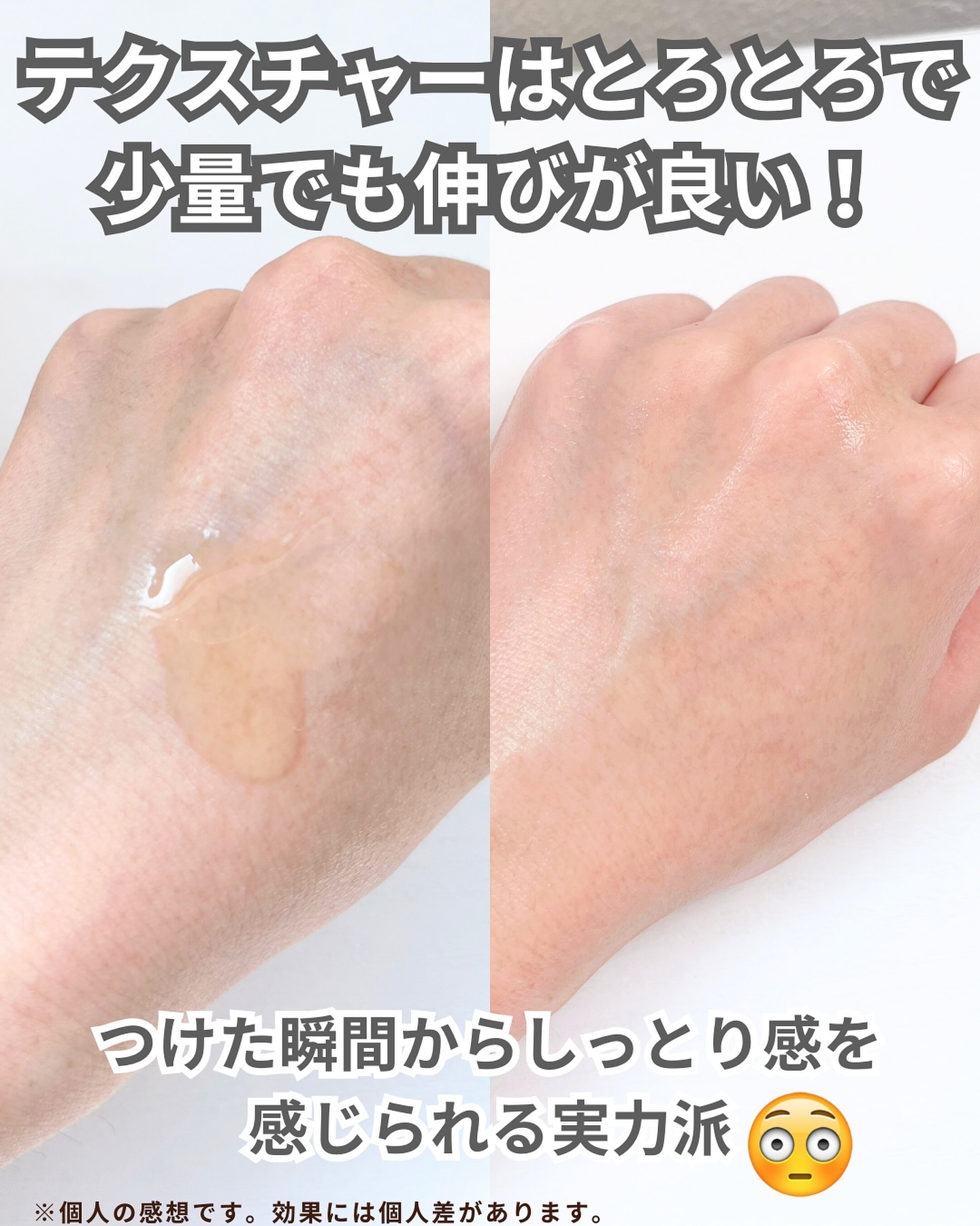 シカテロル美容液/beplain/美容液を使ったクチコミ（3枚目）