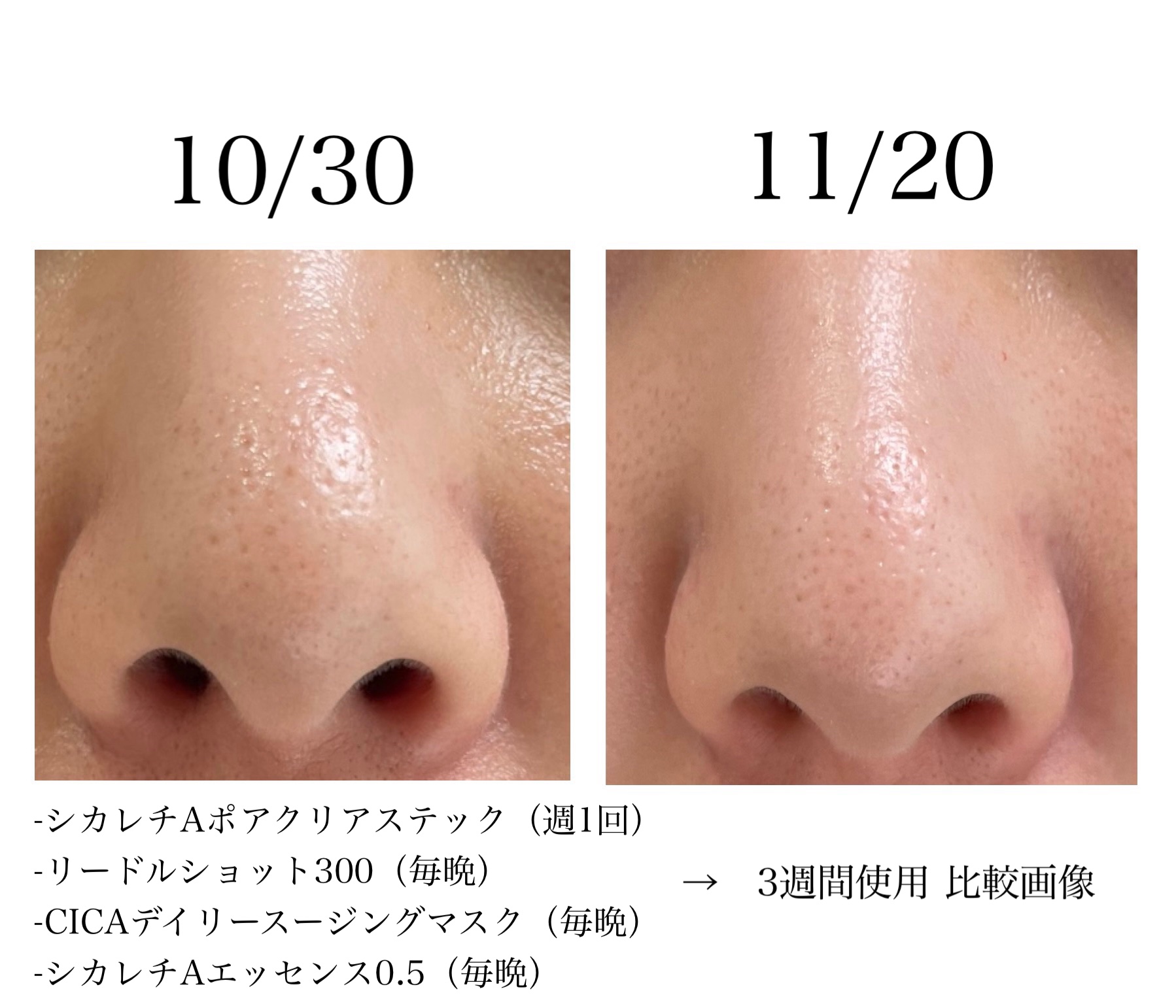 シカレチA エッセンス0.5/VT/美容液を使ったクチコミ（2枚目）