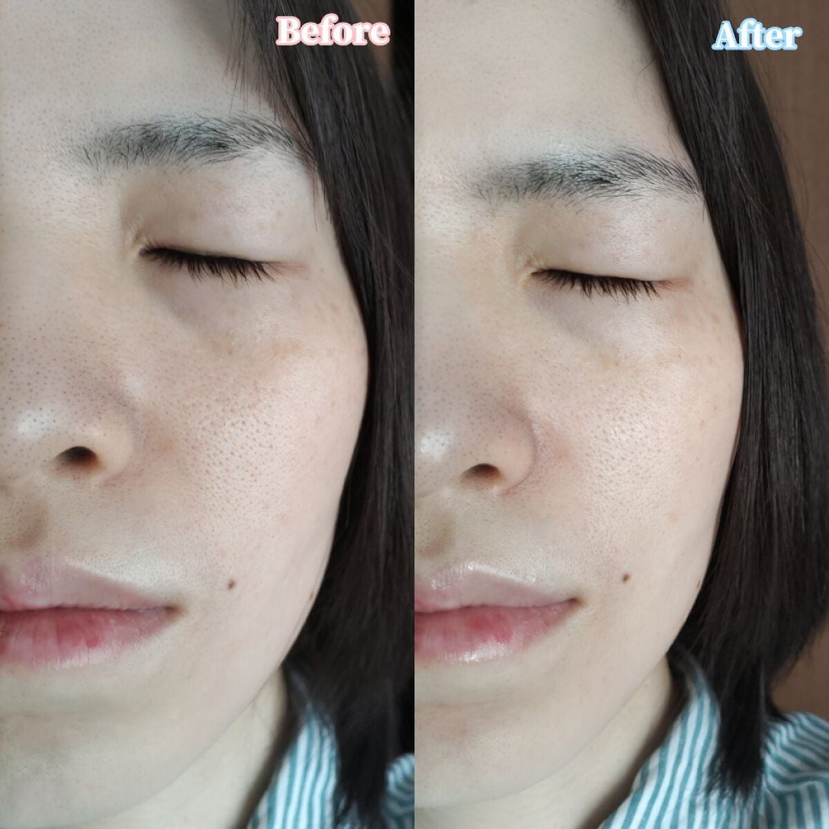 バリアサイクルトナー/P.CALM/化粧水を使ったクチコミ(5枚目)