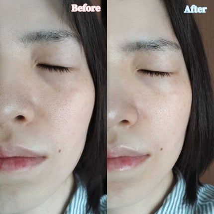 バリアサイクルトナー/P.CALM/化粧水を使ったクチコミ(5枚目)