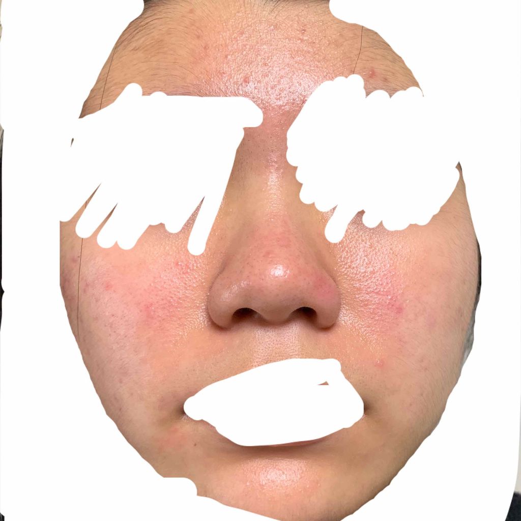 ビジャ シカバーム EX/innisfree/フェイスバームを使ったクチコミ（2枚目）