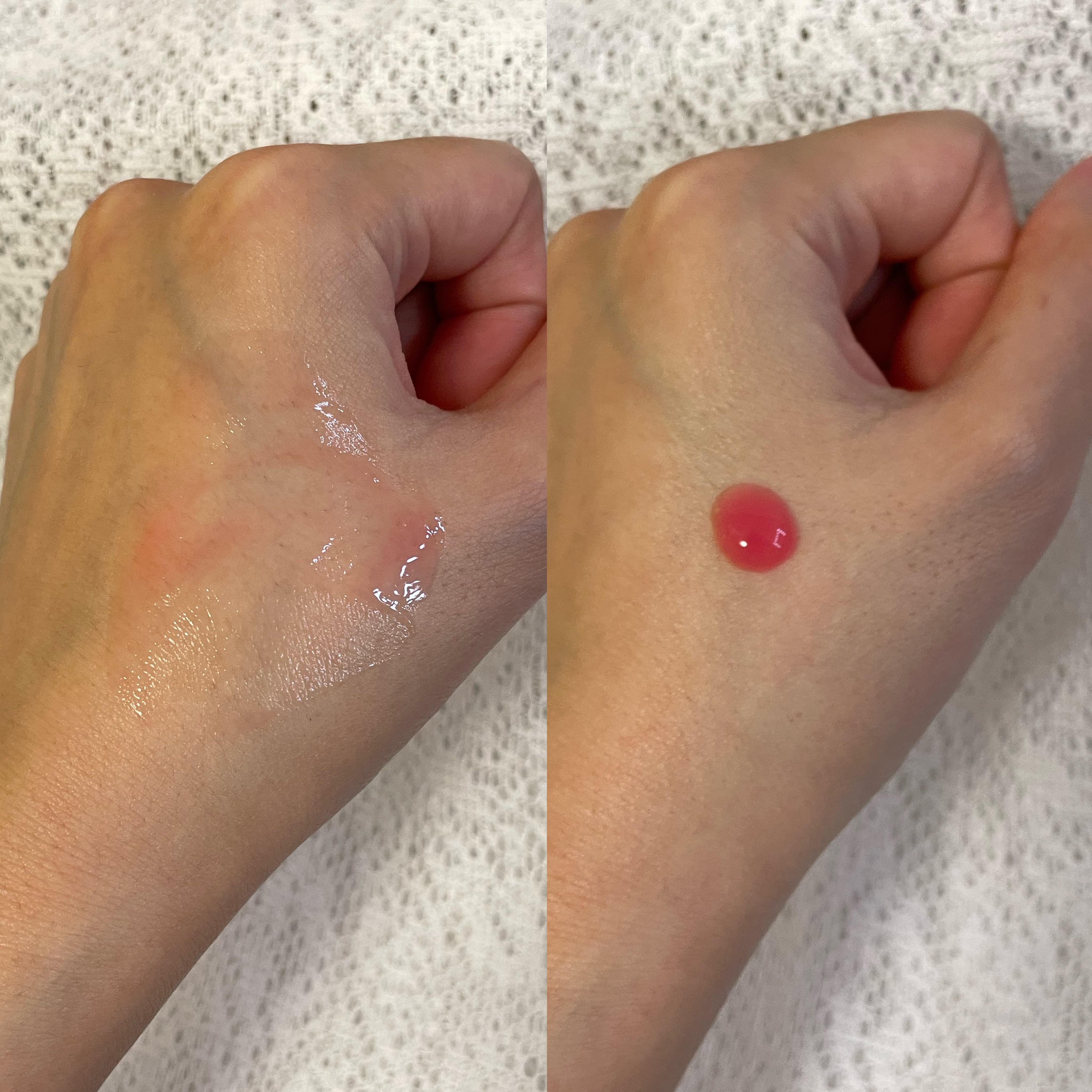 セメンリトシアノ ピンクスピキュールセラム/Dr.Melaxin/美容液を使ったクチコミ（3枚目）