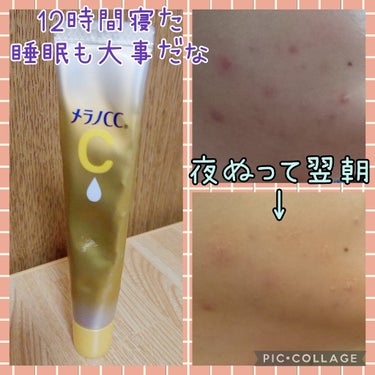 薬用しみ集中対策 プレミアム美容液/メラノCC/美容液を使ったクチコミ（1枚目）