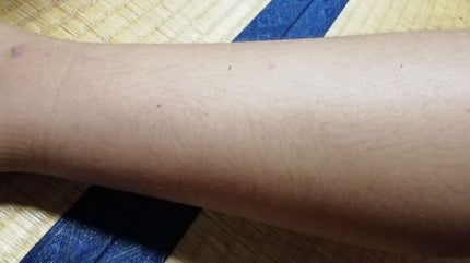 モテ肌 除毛パッド/セリア/ムダ毛ケアを使ったクチコミ(4枚目)