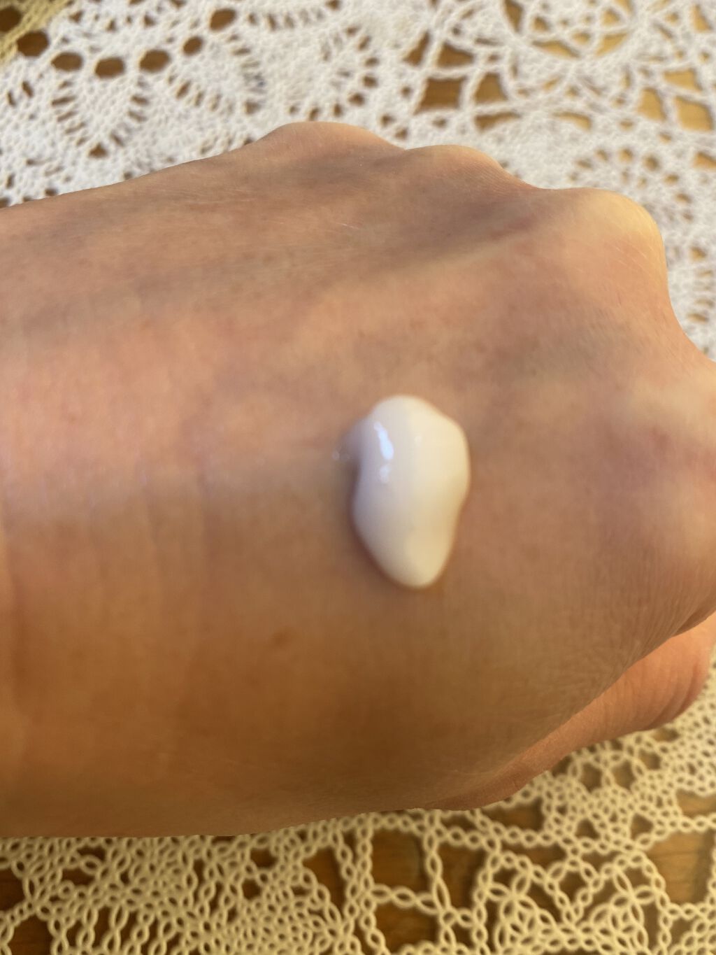 薬用オルリッチ/エクスボーテ/乳液を使ったクチコミ（3枚目）