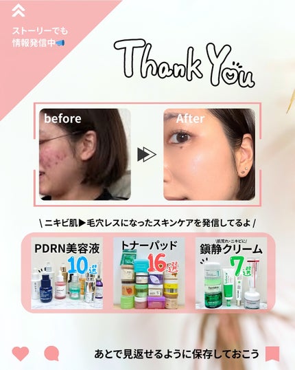 なぎ | スキンケア薬剤師 on LIPS 「ニキビ・毛穴・ニキビ跡…/肌悩み別おすすめ✨こんばんは、なぎで..」(10枚目)