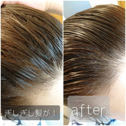 ヘッドスパセブン トリートメント/ヘッドスパセブン/頭皮トリートメントを使ったクチコミ(4枚目)