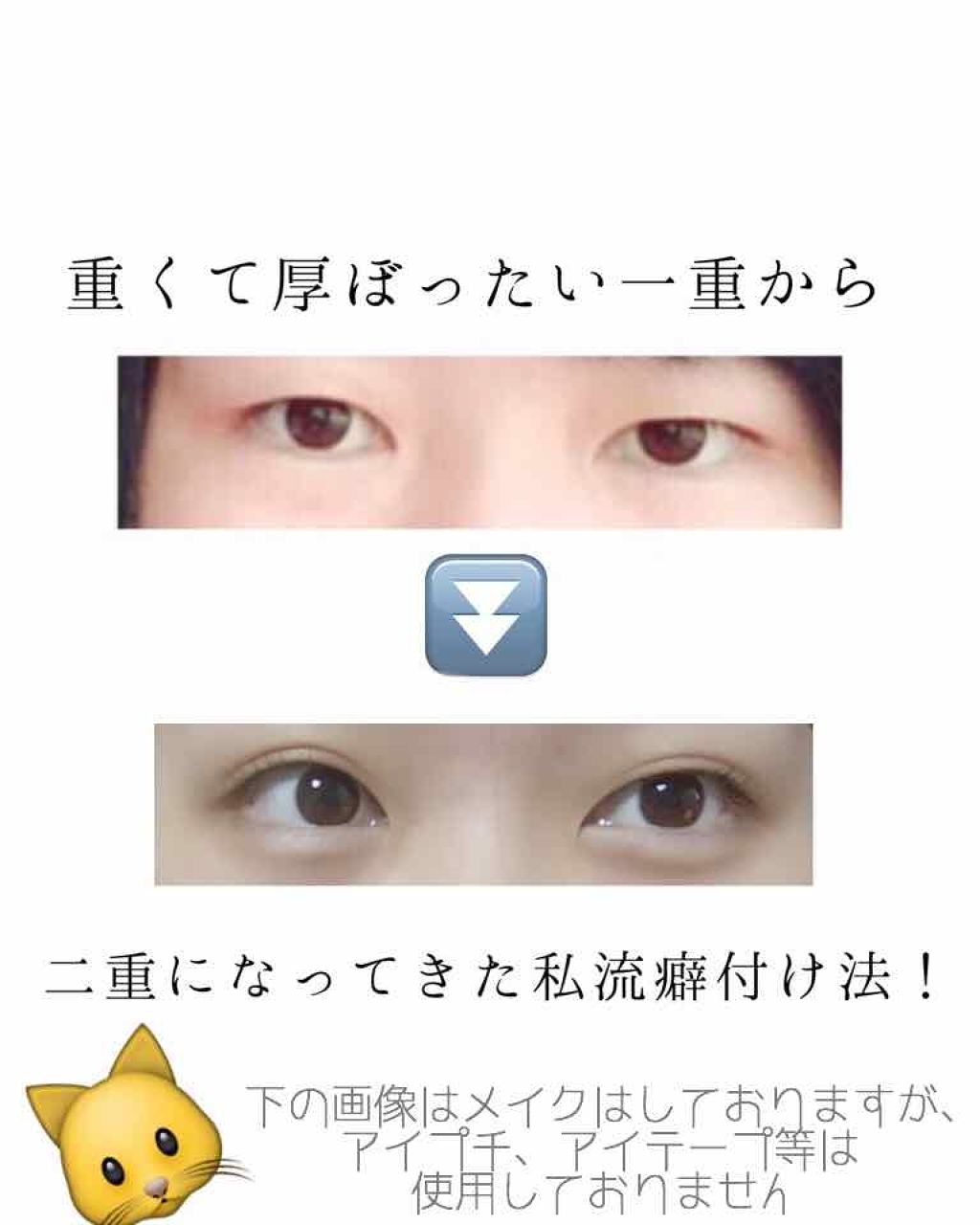 救急絆創膏/その他を使ったクチコミ（1枚目）