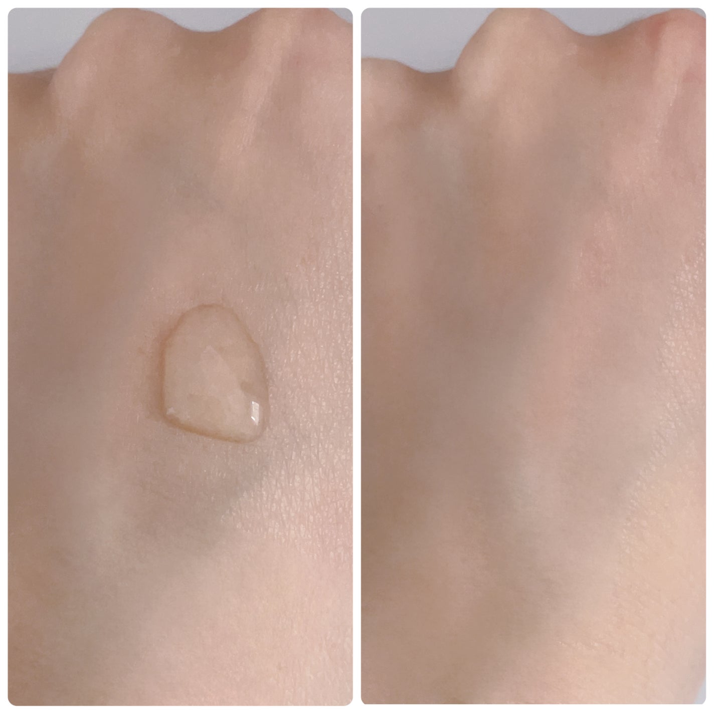 センテラ アンプル/SKIN1004/美容液を使ったクチコミ(3枚目)