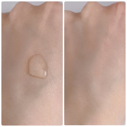 センテラ アンプル/SKIN1004/美容液を使ったクチコミ(3枚目)