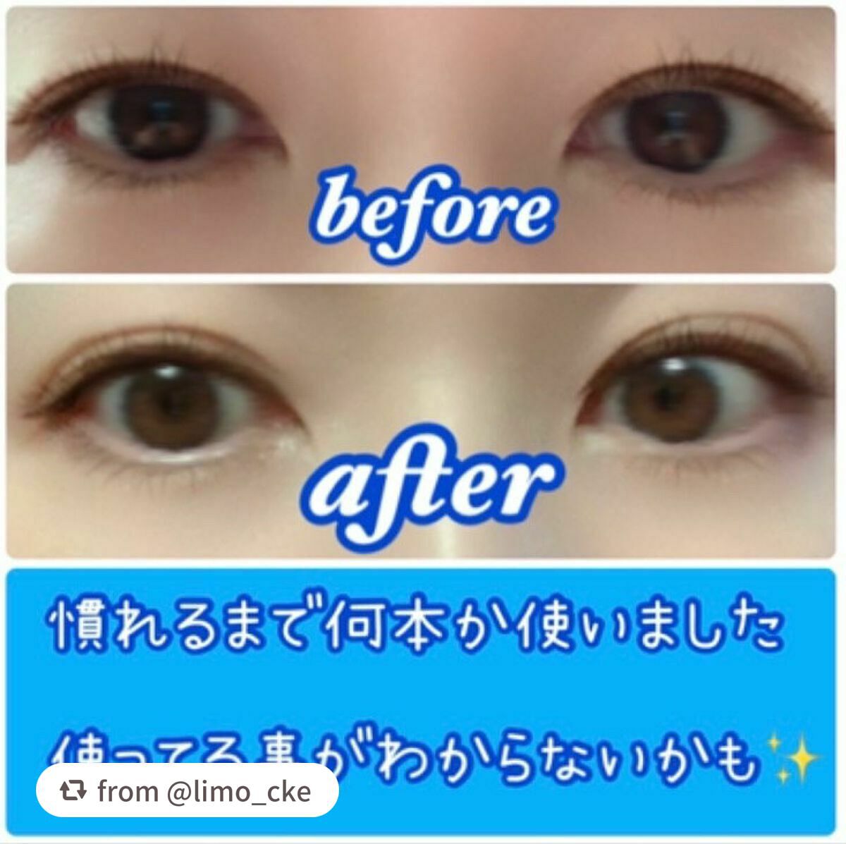 マイクロファイバー /ビー・エヌ/二重まぶた用アイテムを使ったクチコミ(6枚目)