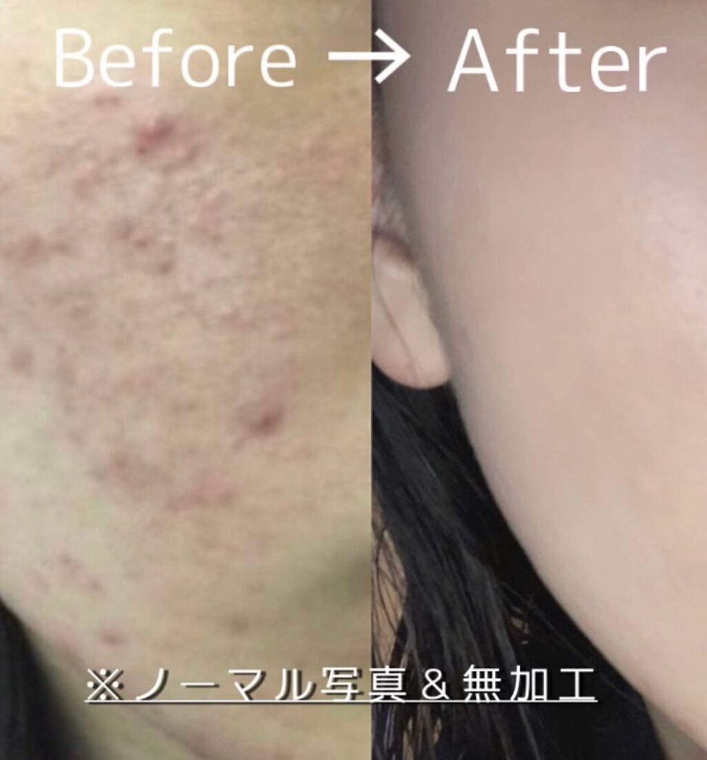 お米のマスク/毛穴撫子/シートマスク・パックを使ったクチコミ(1枚目)