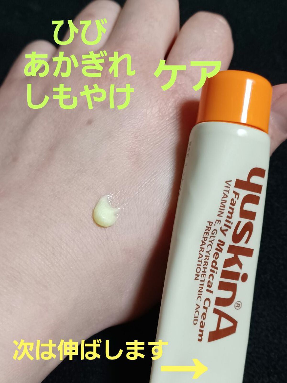 ユースキン/ユースキン/ボディクリームを使ったクチコミ(1枚目)