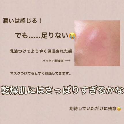 CICA デイリースージングマスク/VT/シートマスク・パックを使ったクチコミ(3枚目)