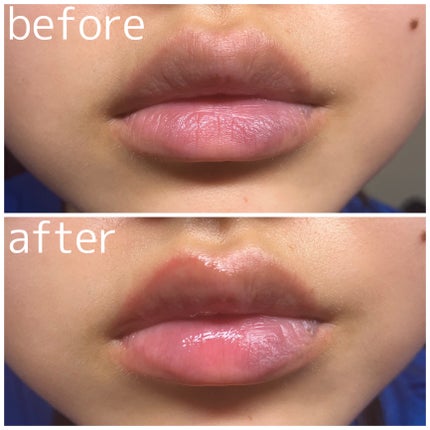 ジュエリアプレミアム リップボム/ジュエリアプレミアム/リップグロスを使ったクチコミ(2枚目)