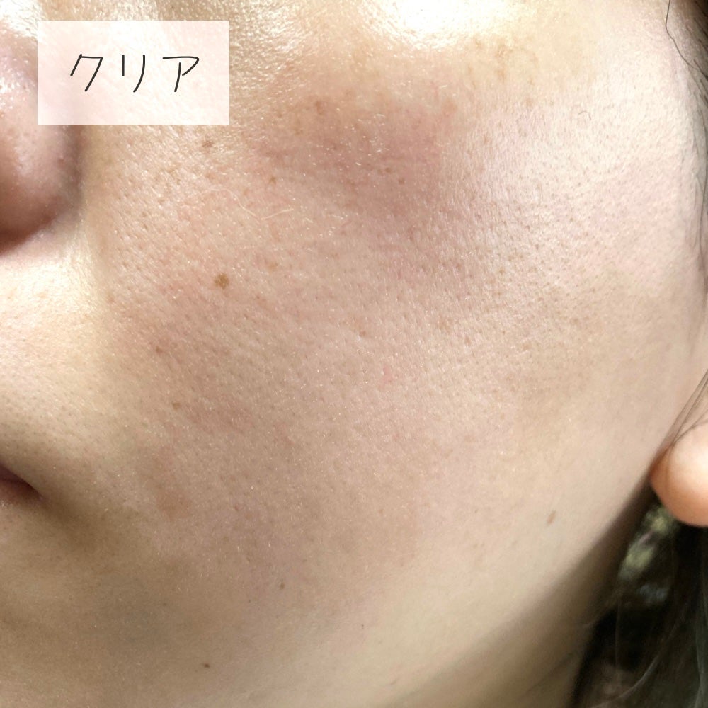 UVイデア XL プロテクショントーンアップ ローズ/ラ ロッシュ ポゼ/日焼け止めクリームを使ったクチコミ(6枚目)