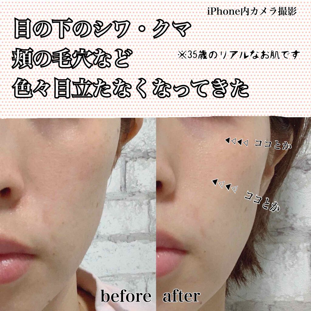 yuko.h.cosme@suke on LIPS 「LUXCEARVisage美顔器と専用のジェルを頂いてモ..」(2枚目)