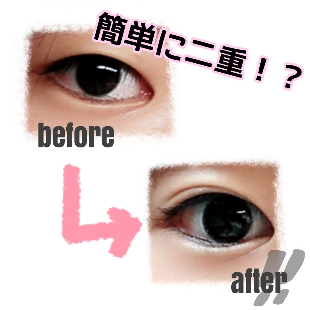 アイビューティー フィクサー WP/アストレア ヴィルゴ/二重まぶた用アイテムを使ったクチコミ（1枚目）
