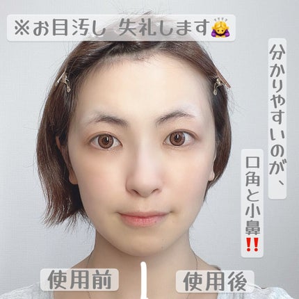 SAIBOW セラム/ドクターソワ/美容液を使ったクチコミ(4枚目)