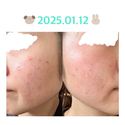 を使ったクチコミ(1枚目)