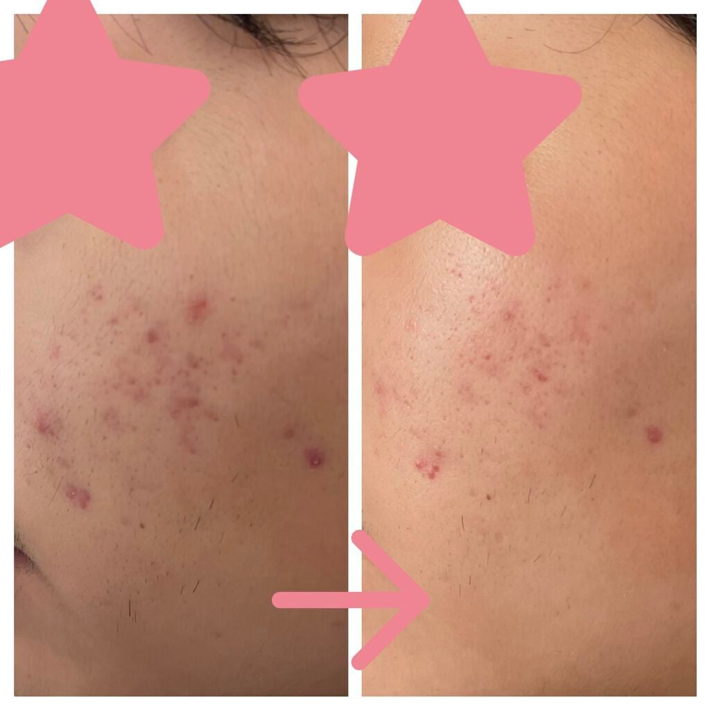 明色美顔水 薬用化粧水/美顔/化粧水を使ったクチコミ(2枚目)