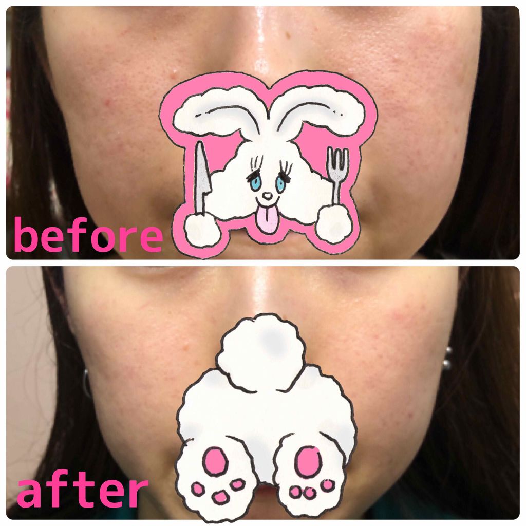 7 day Special Set プログラム3/b.glen/トライアルキットを使ったクチコミ（2枚目）