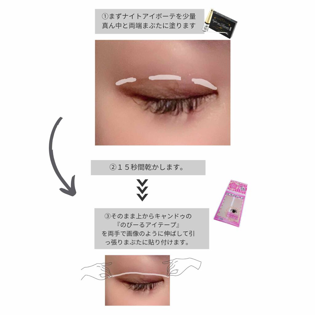 二重になる方法》ナイトアイボーテ|StreeTrendの使い方や二重 二重になる方法》ナイトアイボーテ|StreeTrendの使い方や二重