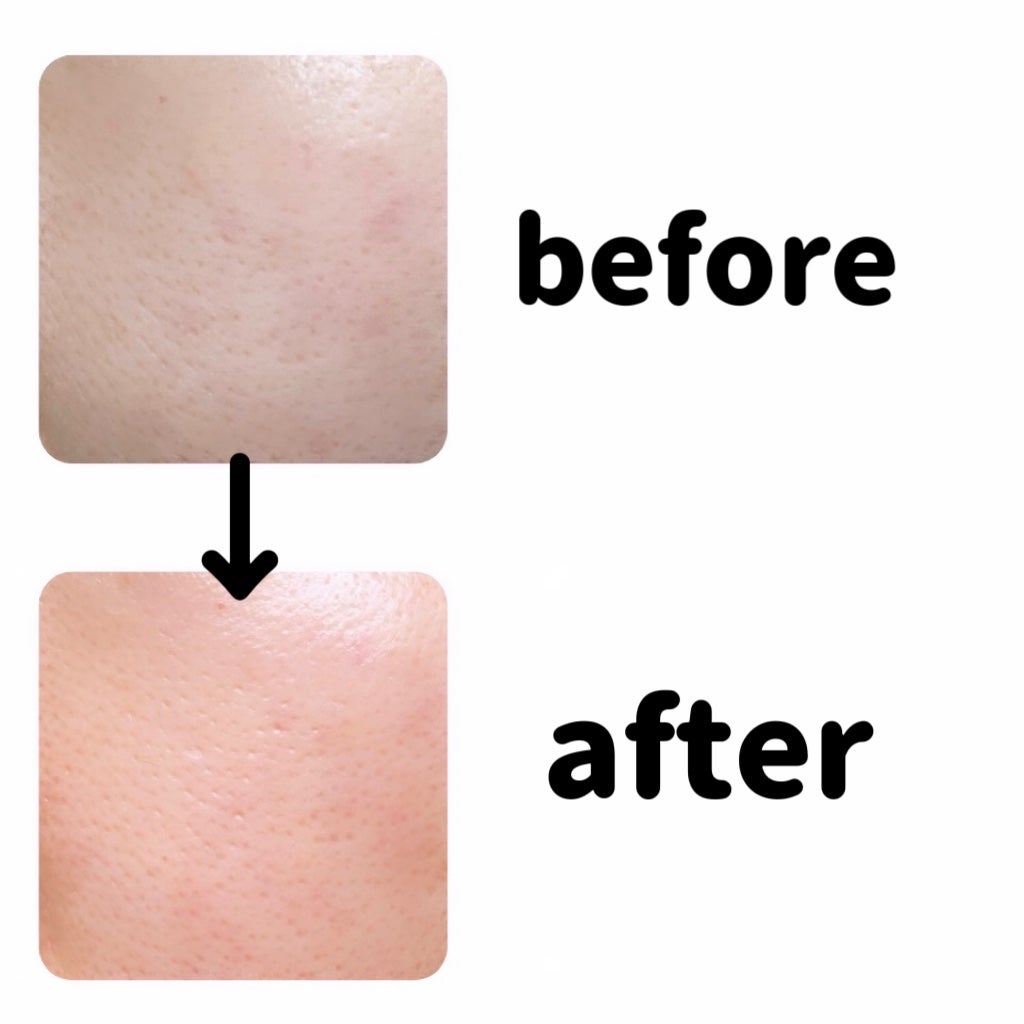 シカバイタル エッセンス/VT/美容液を使ったクチコミ(4枚目)