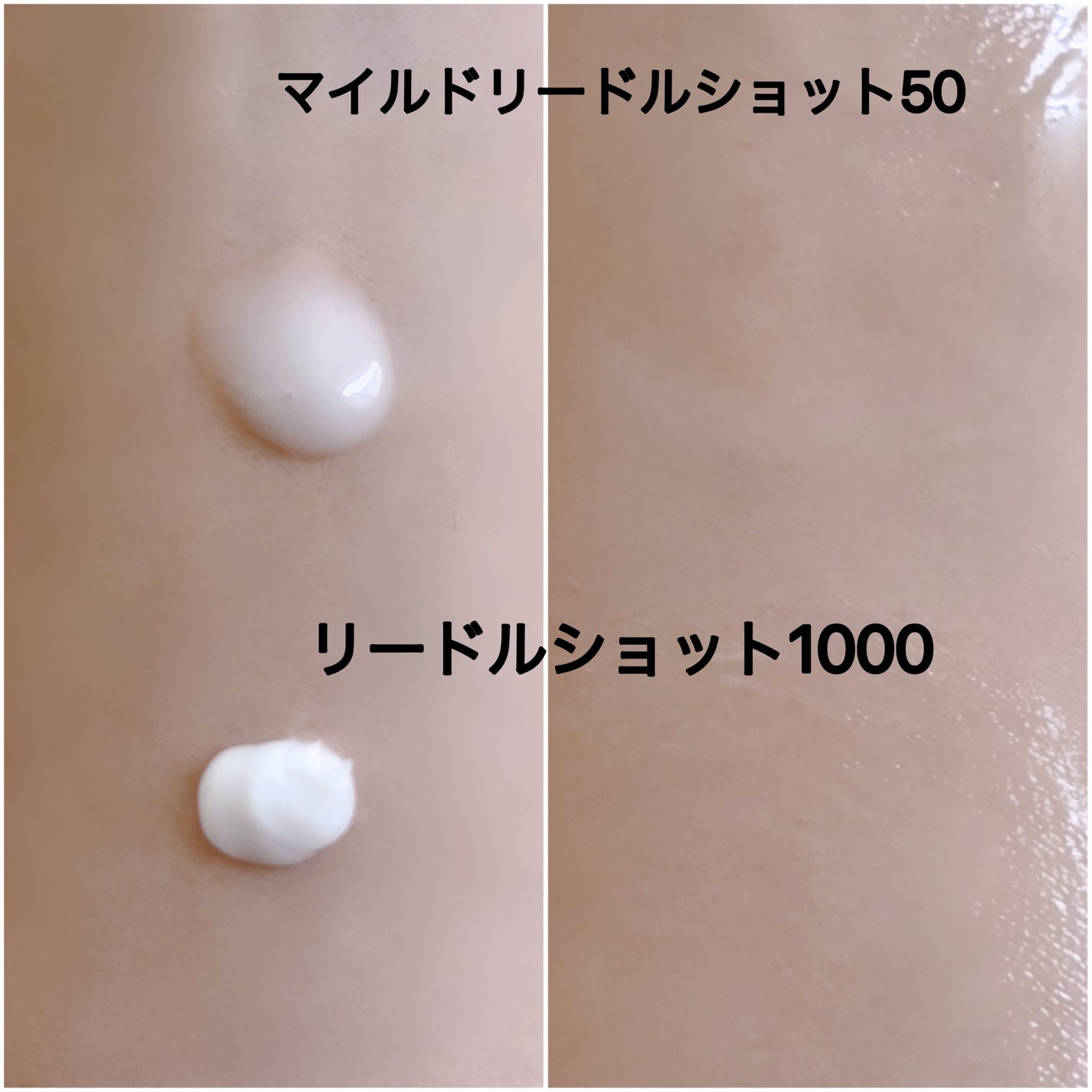 マイルドリードルショット50/VT/美容液を使ったクチコミ(4枚目)